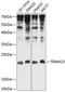 Mitochondrial import inner membrane translocase subunit Tim23 antibody, GTX66539, GeneTex, Western Blot image 