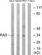 RRAD, Ras Related Glycolysis Inhibitor And Calcium Channel Regulator antibody, PA5-39199, Invitrogen Antibodies, Western Blot image 