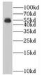Histone-lysine N-methyltransferase SUV39H1 antibody, FNab08404, FineTest, Western Blot image 