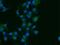 PRL-R antibody, GTX02117, GeneTex, Immunofluorescence image 