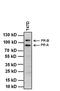 Progesterone Receptor antibody, MA1-410, Invitrogen Antibodies, Western Blot image 