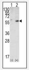 Phosphatidylinositol-3,4,5-trisphosphate 3-phosphatase and dual-specificity protein phosphatase PTEN antibody, AP15248PU-N, Origene, Western Blot image 