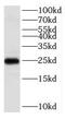 Potassium Voltage-Gated Channel Interacting Protein 1 antibody, FNab04487, FineTest, Western Blot image 