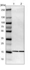Ubiquitin Conjugating Enzyme E2 I antibody, NBP1-86887, Novus Biologicals, Western Blot image 