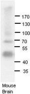 Adenosine Deaminase RNA Specific B1 antibody, TA345762, Origene, Western Blot image 