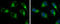 3-ketoacyl-CoA thiolase, mitochondrial antibody, GTX115416, GeneTex, Immunocytochemistry image 
