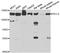 Lymphoid-specific helicase antibody, A5831, ABclonal Technology, Western Blot image 