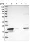 Thioesterase Superfamily Member 6 antibody, NBP1-84052, Novus Biologicals, Western Blot image 