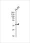 Haptoglobin-Related Protein antibody, PA5-48124, Invitrogen Antibodies, Western Blot image 