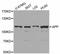 Amyloid Beta Precursor Protein antibody, A0206, ABclonal Technology, Western Blot image 