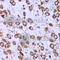 Ribosomal Protein S10 antibody, A5880, ABclonal Technology, Immunohistochemistry paraffin image 