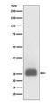TIMP Metallopeptidase Inhibitor 1 antibody, M00561-1, Boster Biological Technology, Western Blot image 