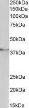 P2X purinoceptor 4 antibody, 43-001, ProSci, Enzyme Linked Immunosorbent Assay image 