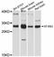 Sideroflexin 3 antibody, LS-C747426, Lifespan Biosciences, Western Blot image 