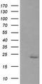 RAB30, Member RAS Oncogene Family antibody, TA505343BM, Origene, Western Blot image 
