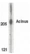 Apoptotic Chromatin Condensation Inducer 1 antibody, PA5-19939, Invitrogen Antibodies, Western Blot image 