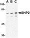 Protein Tyrosine Phosphatase Non-Receptor Type 11 antibody, orb74752, Biorbyt, Western Blot image 