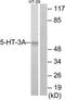 5-Hydroxytryptamine Receptor 3A antibody, TA312523, Origene, Western Blot image 