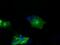 Atrial natriuretic peptide receptor 3 antibody, GTX84008, GeneTex, Immunofluorescence image 