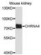 Cholinergic Receptor Nicotinic Alpha 4 Subunit antibody, abx135722, Abbexa, Western Blot image 