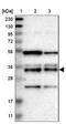 Translocase Of Outer Mitochondrial Membrane 34 antibody, NBP1-81655, Novus Biologicals, Western Blot image 
