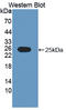 Ribonuclease A Family Member 9 (Inactive) antibody, LS-C375045, Lifespan Biosciences, Western Blot image 