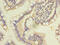 DENN Domain Containing 2D antibody, CSB-PA887987LA01HU, Cusabio, Immunohistochemistry paraffin image 