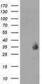 Metabolism Of Cobalamin Associated C antibody, LS-C174052, Lifespan Biosciences, Western Blot image 