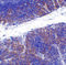 TNF Receptor Superfamily Member 14 antibody, 3775, ProSci Inc, Immunohistochemistry paraffin image 