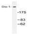 Death-inducer obliterator 1 antibody, AP20551PU-N, Origene, Western Blot image 