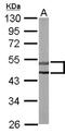 Serine/Threonine Kinase 32C antibody, NBP1-33507, Novus Biologicals, Western Blot image 