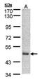 DnaJ Heat Shock Protein Family (Hsp40) Member A2 antibody, orb69990, Biorbyt, Western Blot image 