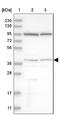 ACAT2 antibody, NBP1-89526, Novus Biologicals, Western Blot image 