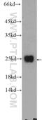 Coiled-Coil Domain Containing 12 antibody, 25138-1-AP, Proteintech Group, Western Blot image 