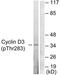 Cyclin D3 antibody, TA313569, Origene, Western Blot image 
