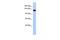 Potassium Voltage-Gated Channel Subfamily H Member 7 antibody, GTX47643, GeneTex, Western Blot image 