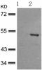Calcium/Calmodulin Dependent Protein Kinase II Inhibitor 2 antibody, TA322112, Origene, Western Blot image 