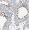Solute Carrier Family 44 Member 5 antibody, NBP2-30869, Novus Biologicals, Immunohistochemistry frozen image 