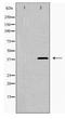Galectin 9 antibody, TA347957, Origene, Western Blot image 