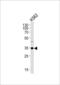 Bardet-Biedl syndrome 5 protein antibody, PA5-49330, Invitrogen Antibodies, Western Blot image 