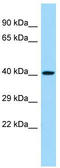 Carbohydrate Sulfotransferase 11 antibody, TA342375, Origene, Western Blot image 