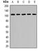 Purinergic Receptor P2X 2 antibody, abx142121, Abbexa, Western Blot image 