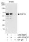 PHD Finger Protein 23 antibody, A302-320A, Bethyl Labs, Immunoprecipitation image 
