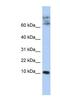 Chemokine Like Factor antibody, NBP1-59506, Novus Biologicals, Western Blot image 