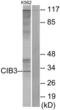 Calcium And Integrin Binding Family Member 3 antibody, LS-C119220, Lifespan Biosciences, Western Blot image 