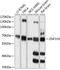 Zinc Finger Protein 319 antibody, 15-484, ProSci, Western Blot image 