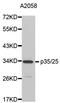Cyclin-dependent kinase 5 activator 1 antibody, MBS125766, MyBioSource, Western Blot image 