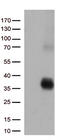 HLA class II histocompatibility antigen, DQ alpha 2 chain antibody, M06238, Boster Biological Technology, Western Blot image 