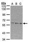 EPM2A-interacting protein 1 antibody, TA308270, Origene, Western Blot image 