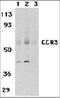 C-C Motif Chemokine Receptor 3 antibody, orb88715, Biorbyt, Western Blot image 